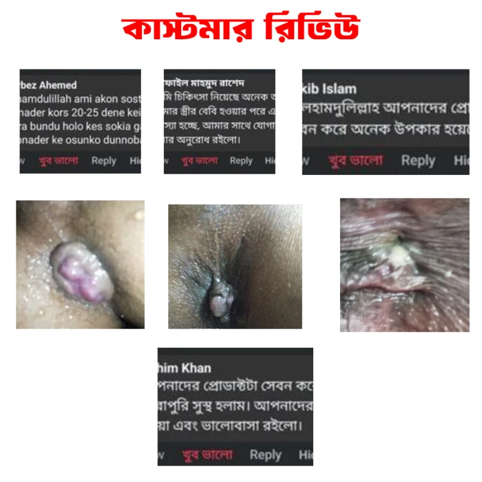 এলিট পিওর পাইলস কেয়ার -1 পিস